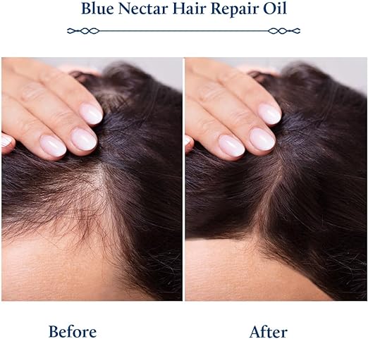 Blue Nectar Rosemary Oil for Hair Growth with Bhringraj Oil for Hair | 100% Natural Ayurvedic Hair Oil with Amla Hair Oil (9 Herbs,100ml)