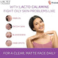 Lacto Calamine Face Lotion for Oil Balance - Oily Skin - 120 ml